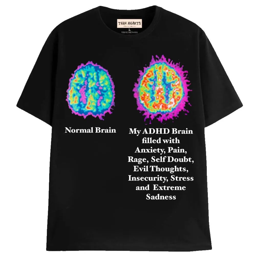 MY ADHD BRAIN