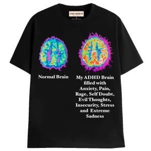 MY ADHD BRAIN